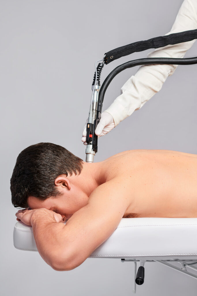 Hair removal laser