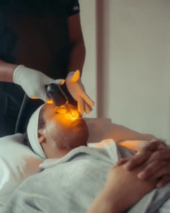 advatx-treatment - Shine Medspa & Microblading - Shine Medspa & Microblading advatx laser skin resurfacing