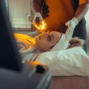 laser1 - Shine Medspa & Microblading - Shine Medspa & Microblading laser skin treatments