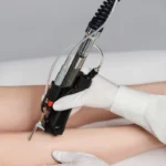 motus ax hair removal