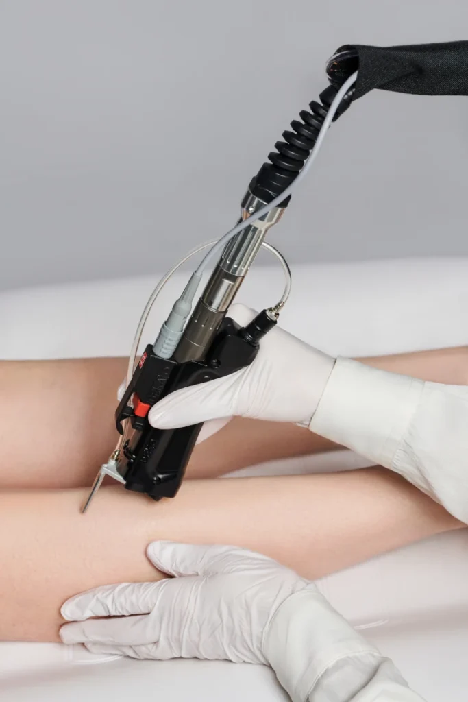 motus ax hair removal