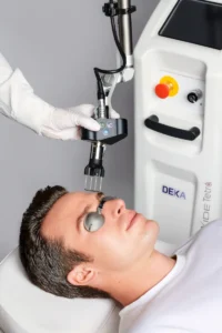 tetraco2 - Shine Medspa & Microblading - Shine Medspa & Microblading