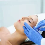 pdo-main - Shine Medspa & Microblading thread lift non-surgical facelift