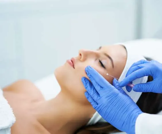 thread lift non-surgical facelift