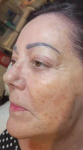 shine-after - Shine Medspa & Microblading - Shine Medspa & Microblading shine after photo