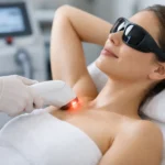 Does Laser Hair Removal Hurt What to Expect - Shine Medspa & Microblading Does Laser Hair Removal Hurt? What to Expect