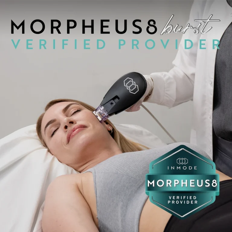 Morpheus8 laser treatment
