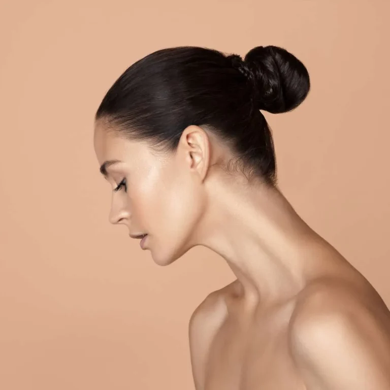 microneedling