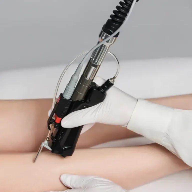 motus ax hair removal