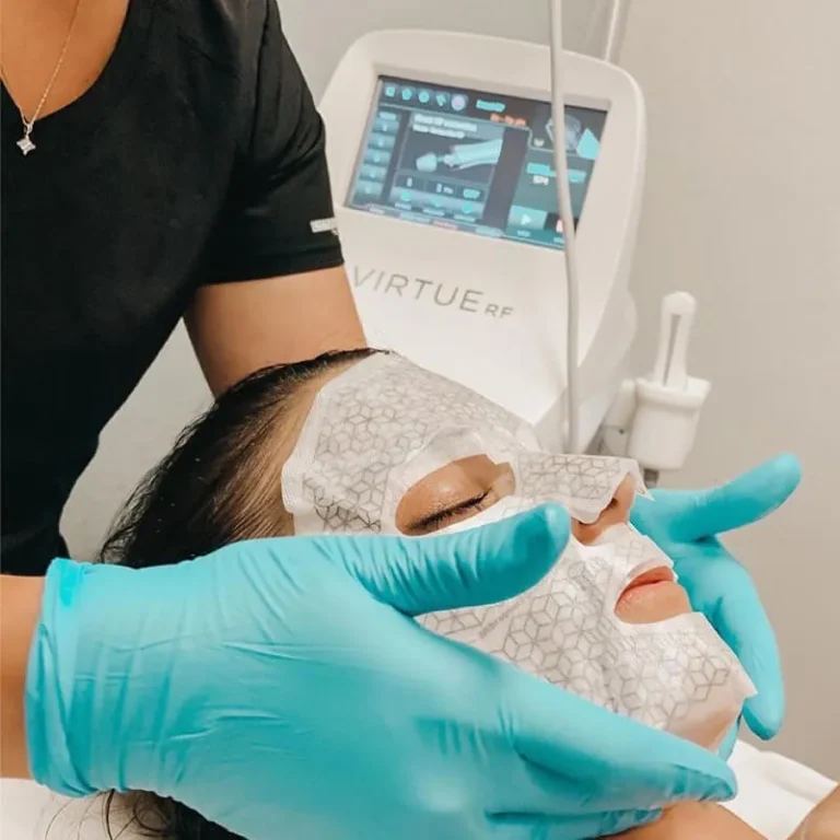 Virtu RF Microneedling